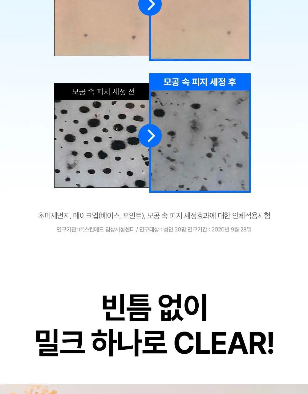 [5/10 하루특가/포켓몬에디션] 듀이트리 하이아미노 올 클렌징 밀크 200ml 기획 (+250ml+세안밴드) 상세페이지 22